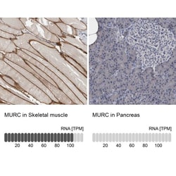 Desmocollin-2 Antibody, Novus Biologicals:Antibodies:Primary Antibodies